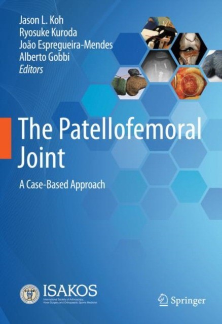 The Patellofemoral Joint: A Case-Based Approach