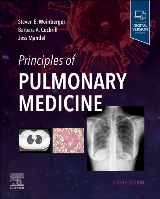 Principles of pulmonary medicine, 8th ed