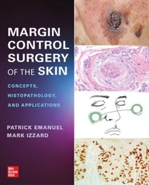 Margin control surgery of the skin: concepts, histopathology, and applications