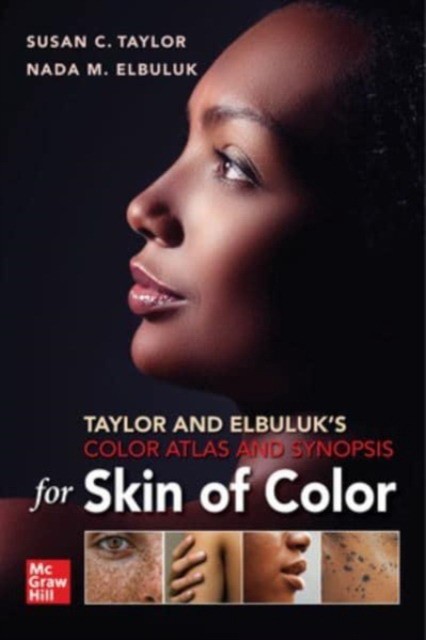 Taylor and elbuluk`s color atlas and synopsis for skin of color