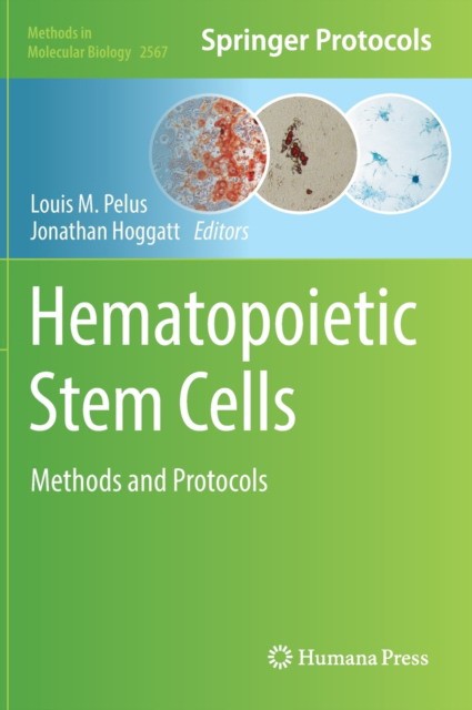 Hematopoietic Stem Cells