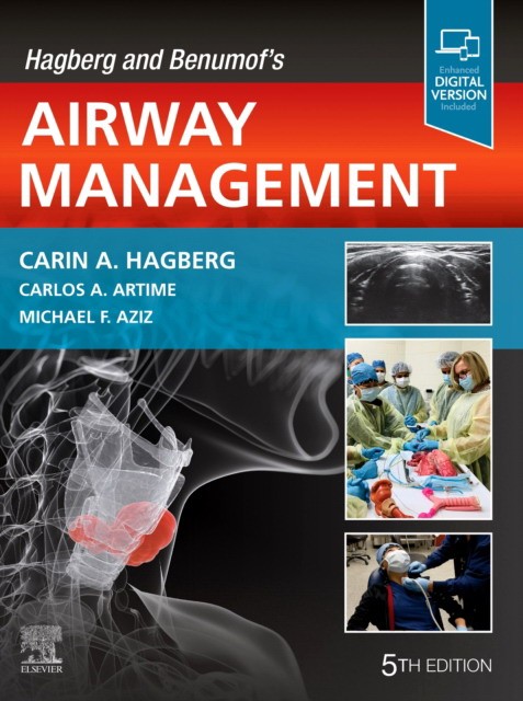 Hagberg and benumof`s airway management