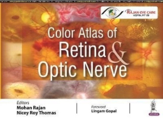 Color Atlas Of Retina & Optic Nerve