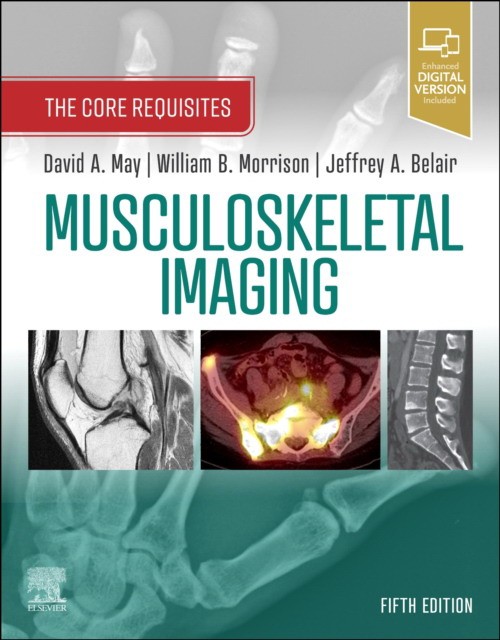 Musculoskeletal imaging: core requisites