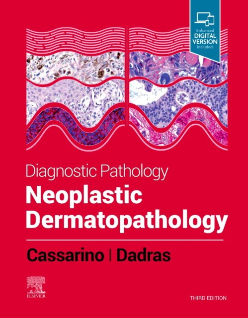 Diagnostic pathology: neoplastic dermatopathology