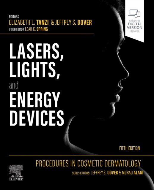 Procedures in cosmetic dermatology: lasers, lights, and energy devices