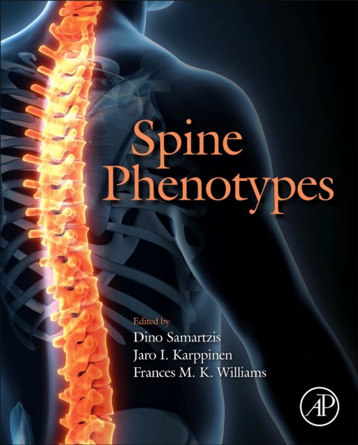 Spine phenotypes