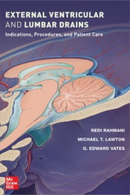 External ventricular and lumbar drains: indications, procedures, and patient care
