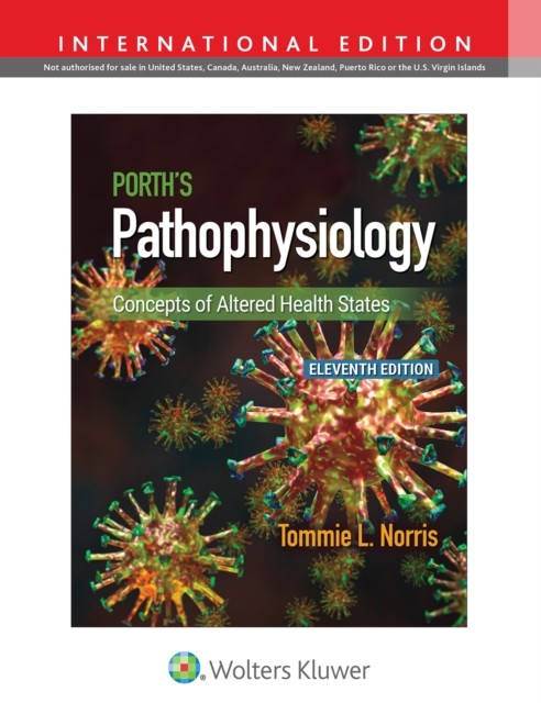 Porth's Pathophysiology: Concepts of Altered Health States Porth's Pathophysiology: Concepts of Altered Health States
