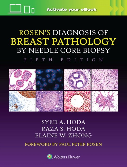 Rosen's Diagnosis of Breast Pathology by Needle Core Biopsy Rosen's Diagnosis of Breast Pathology by Needle Core Biopsy