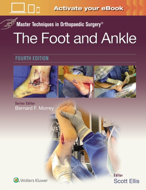 Master Techniques in Orthopaedic Surgery: The Foot and Ankle Master Techniques in Orthopaedic Surgery: The Foot and Ankle