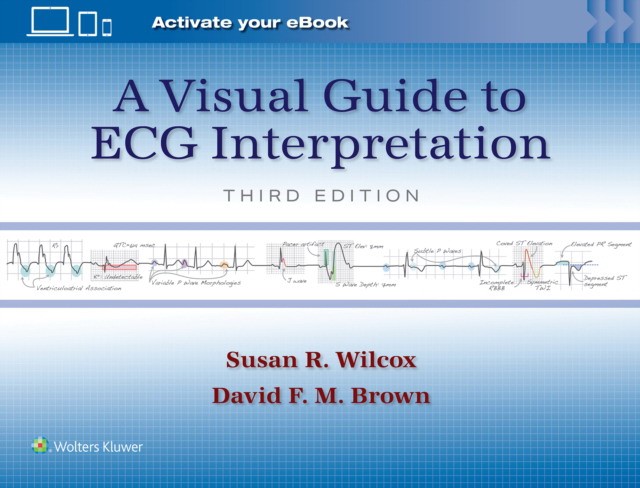 A Visual Guide to ECG Interpretation A Visual Guide to ECG Interpretation