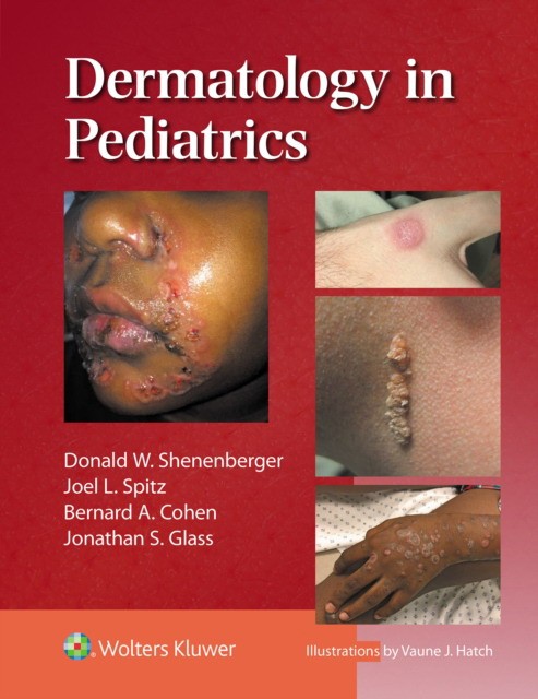 Dermatology In Pediatrics