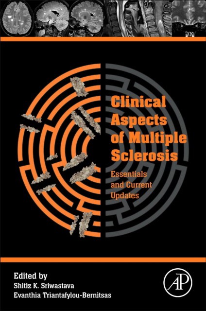 Clinical Aspects Of Multiple Sclerosis Essentials And Current Updates Clinical Aspects Of Multiple Sclerosis Essentials And Current Updates