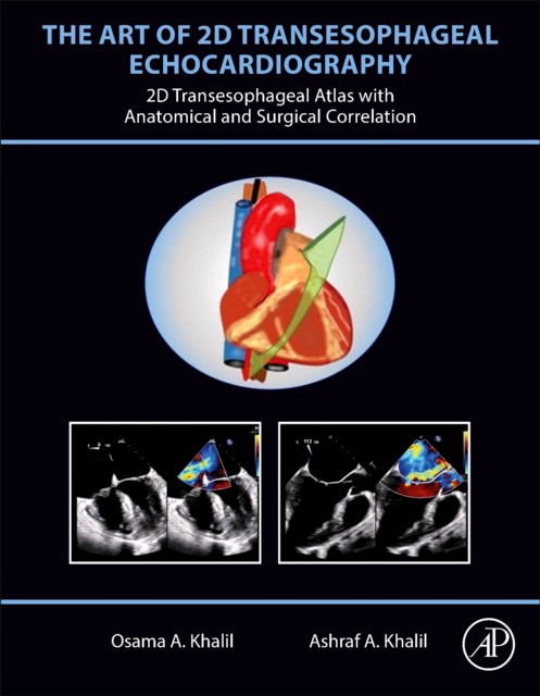 The Art Of 2D Transesophageal Echocardiography The Art Of 2D Transesophageal Echocardiography