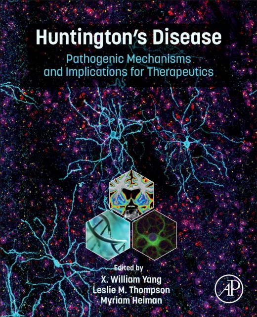 Huntington'S Disease