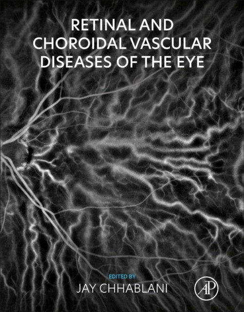 Retinal And Choroidal Vascular Diseases Of The Eye