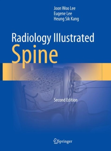 Radiology Illustrated: Spine Radiology Illustrated: Spine