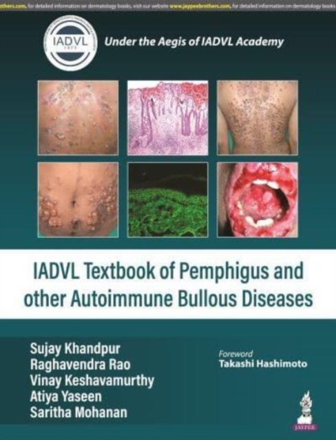 IADVL Textbook of Pemphigus and other Autoimmune Bullous Diseases IADVL Textbook of Pemphigus and other Autoimmune Bullous Diseases