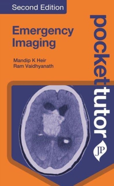 Pocket Tutor Emergency Imaging: Second Edition. JayPee Brothers India, 2022: 9781787791206