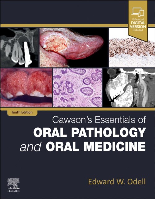 Cawson`s essentials of oral pathology and oral medicine