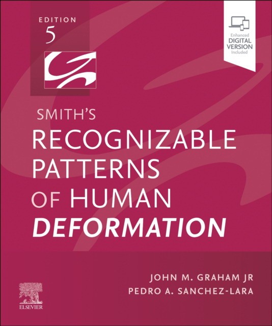 Smith`s recognizable patterns of human deformation