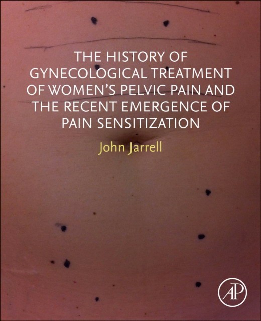 The History Of Gynecological Treatment Of Women'S Pelvic Pain And Therecent Emergence Of Pain Sensitization