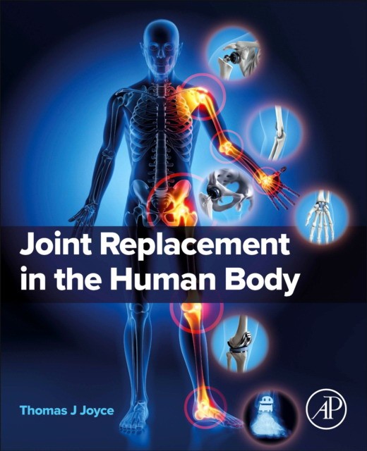 Joint Replacement In The Human Body