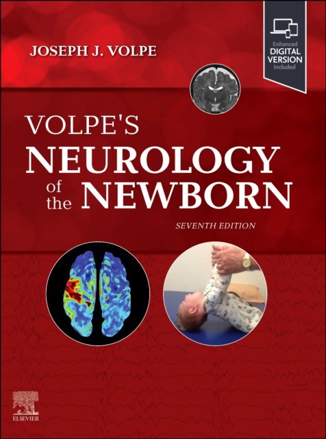 Volpe`s neurology of the newborn