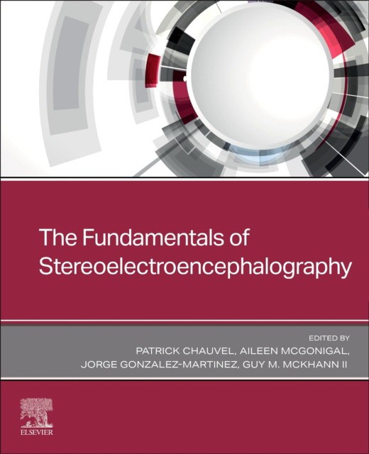 The Fundamentals of Stereoelectroencephalography The Fundamentals of Stereoelectroencephalography