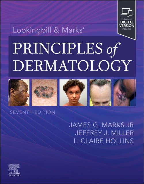 Lookingbill & Marks’ Principles of Dermatology