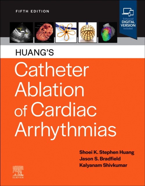 Huang's Catheter Ablation of Cardiac Arrhythmias Huang's Catheter Ablation of Cardiac Arrhythmias