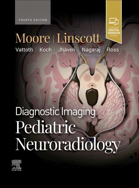 Diagnostic Imaging: Pediatric Neuroradiology Diagnostic Imaging: Pediatric Neuroradiology