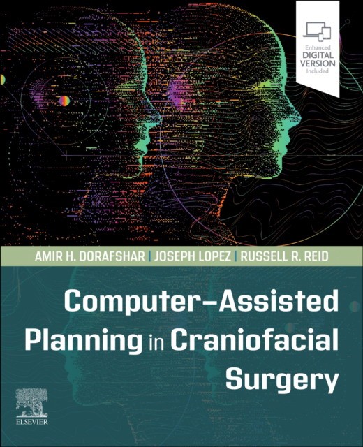 Computer-Assisted Planning in Craniofacial Surgery Computer-Assisted Planning in Craniofacial Surgery