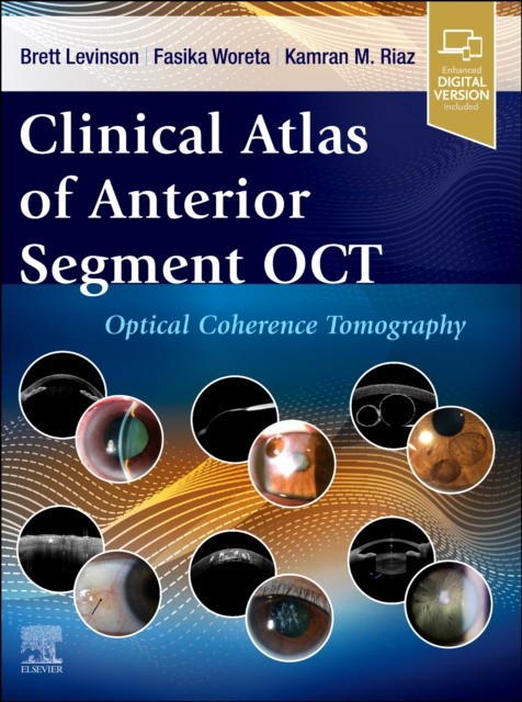 Clinical Atlas of Anterior Segment OCT: Optical Coherence Tomography Clinical Atlas of Anterior Segment OCT: Optical Coherence Tomography