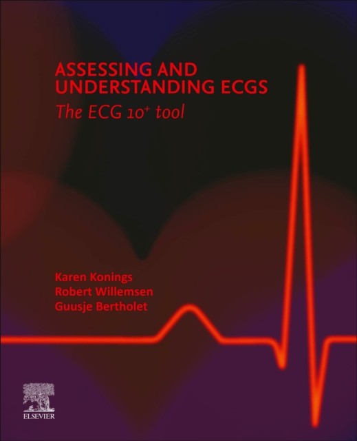 Assessing and Understanding ECGs: The ECG 10+ tool Assessing and Understanding ECGs: The ECG 10+ tool