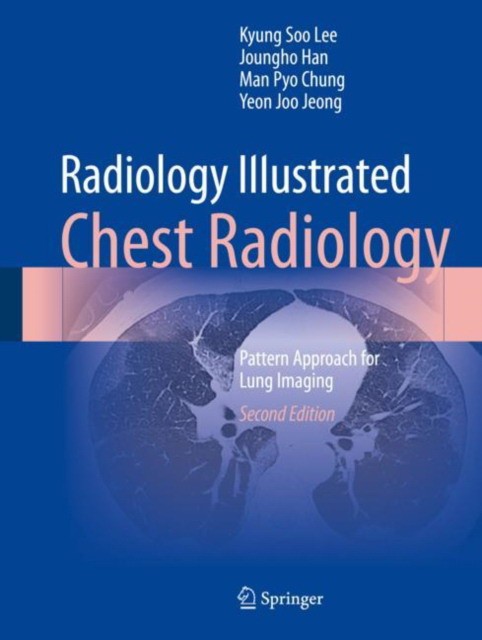 Radiology Illustrated: Chest Radiology Radiology Illustrated: Chest Radiology