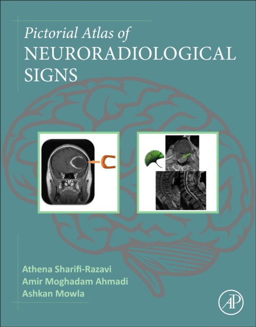 Pictorial Atlas Of Neuroradiological Signs