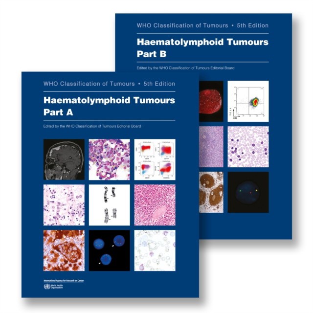 WHO Classification of Tumours Haematolymphoid Tumours. 5 ed. WHO Classification of Tumours Haematolymphoid Tumours. 5 ed.