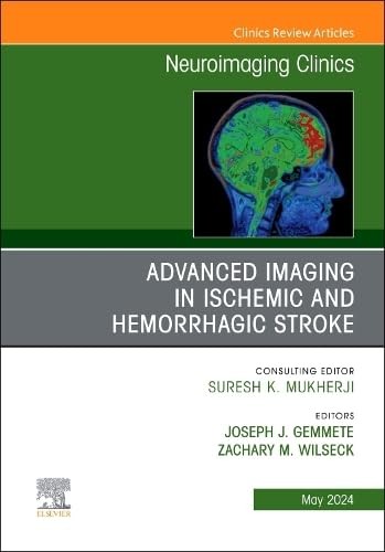 Advanced imaging in ischemic and hemorrhagic stroke, an issue of neuroimaging clinics of north america