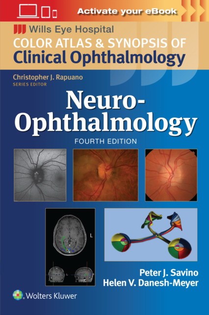 Neuro-ophthalmology: print + ebook with multimedia