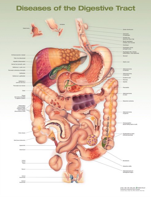 Diseases of the digestive tract anatomical chart