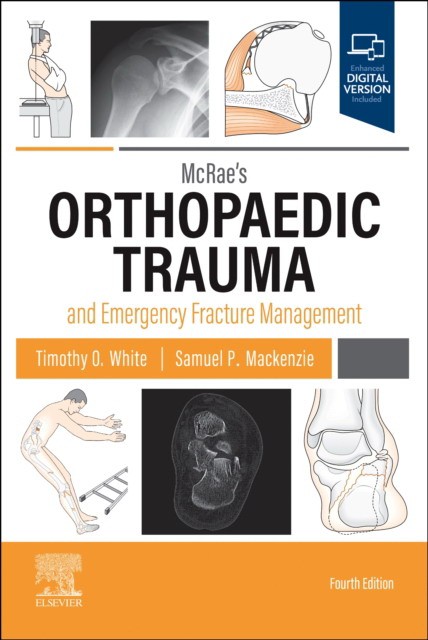 Mcrae'S Orthopaedic Trauma And Emergency Fracture Management