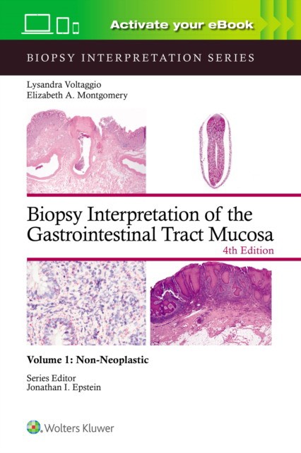 Biopsy interpretation of the gastrointestinal tract mucosa volume 1