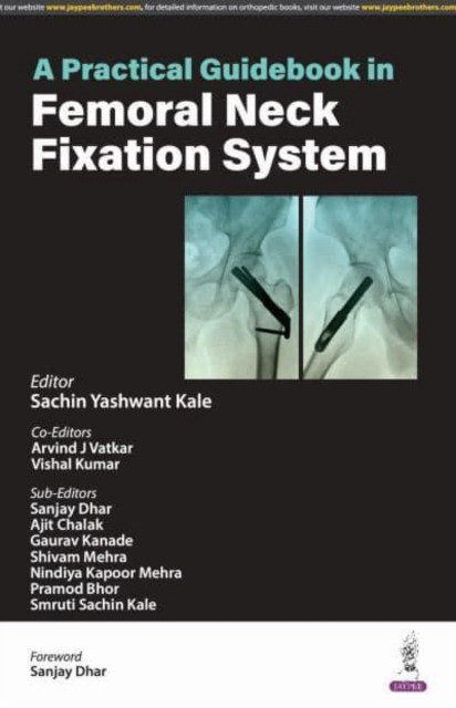 A Practical Guidebook in Femoral Neck Fixation System