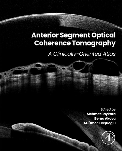 Anterior Segment Optical Coherence Tomography