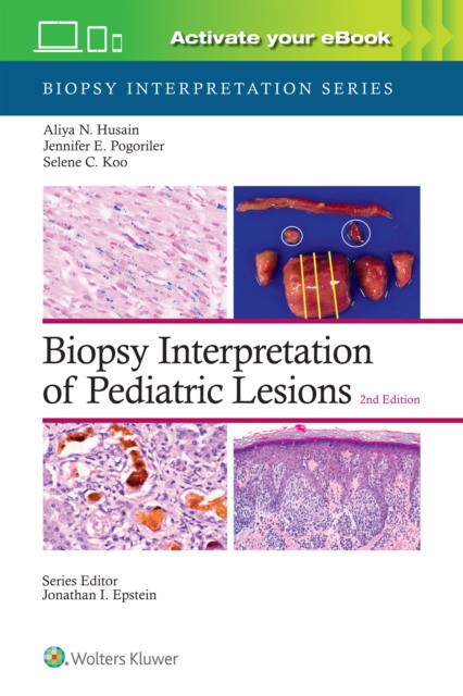 Biopsy interpretation of pediatric lesions: print + ebook with multimedia