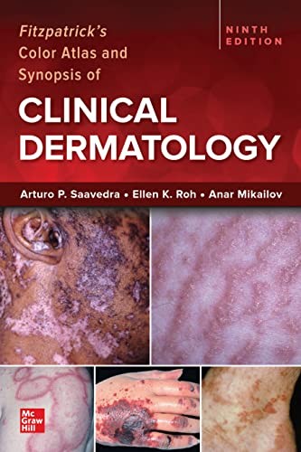 Fitzpatrick`s color atlas and synopsis of clinical dermatology, IE 9 edition Fitzpatrick`s color atlas and synopsis of clinical dermatology, IE 9 edition