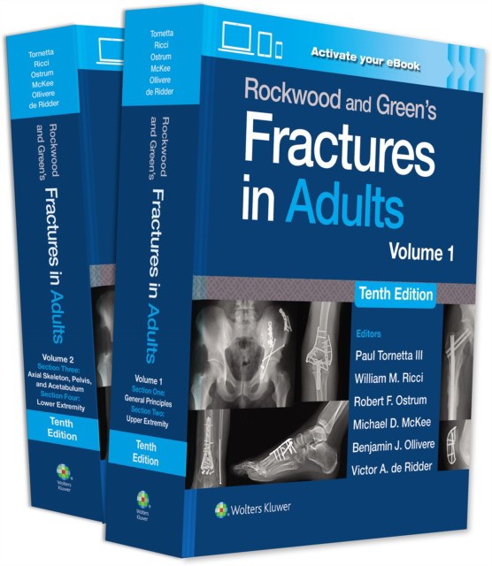 Rockwood and Green's Fractures in Adults: Print + eBook with Multimedia Rockwood and Green's Fractures in Adults: Print + eBook with Multimedia