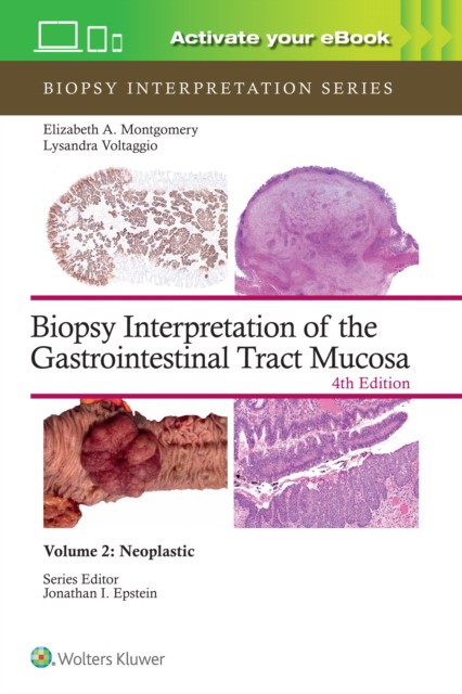 Biopsy Interpretation of the Gastrointestinal Tract Mucosa Volume 2: Neoplastic: Print + eBook with Multimedia